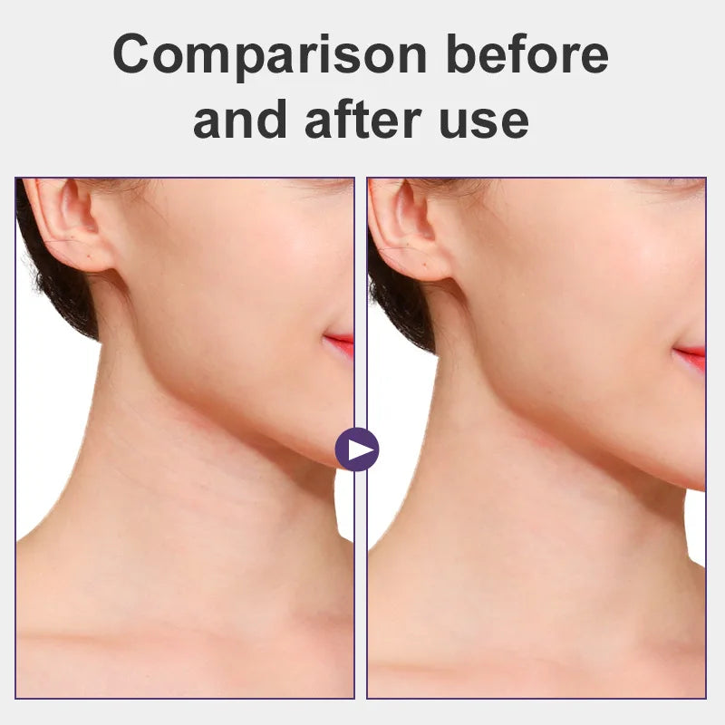 NeckTite™ Instant Lift Tape System